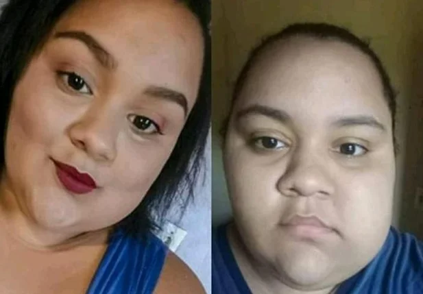 Maria Rita antes e depois do crescimento do cisto