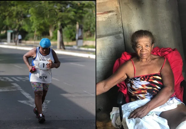 Maria da Conceição da Cunha Bispo antes e depois do acidente