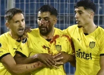 Jogador do Peñarol é atingido por pedra