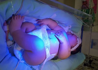 Bebê que nasceu com mais de 7kg