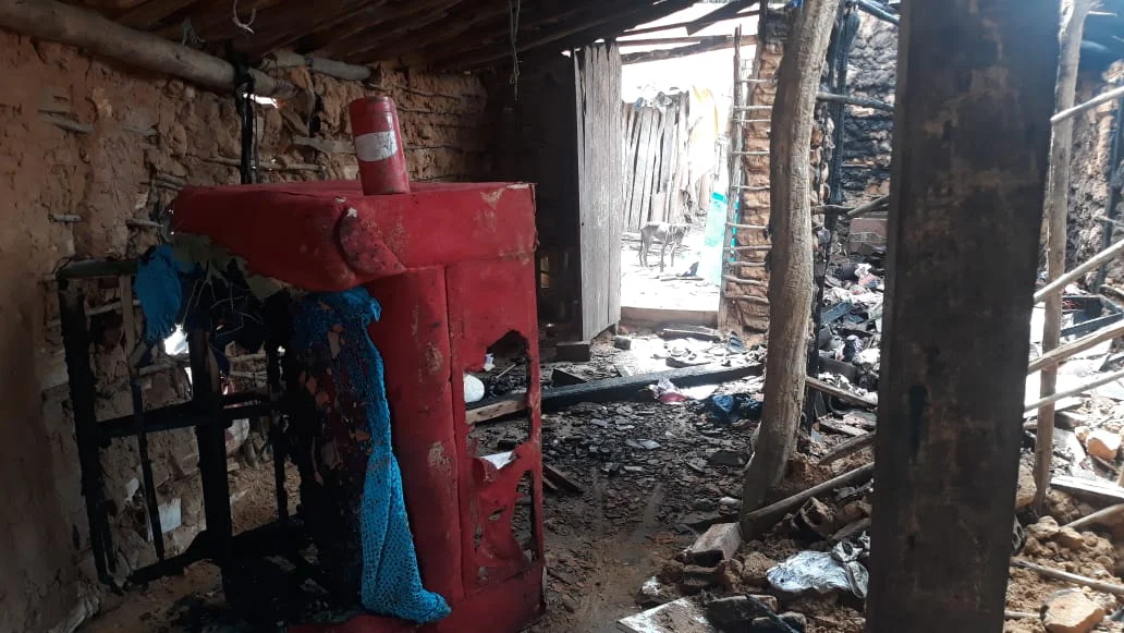 Criança teve 36% do corpo queimado durante incêndio em Parnaíba