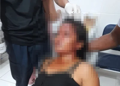Vítima ficou com vários ferimentos no rosto, couro cabeludo e no busto