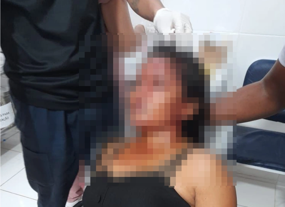 Vítima ficou com vários ferimentos no rosto, couro cabeludo e no busto