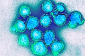 Vírus Influenza H3N2