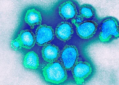 Vírus Influenza H3N2
