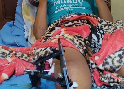 Yago Ferreira precisa passar por cirurgia e pede ajuda