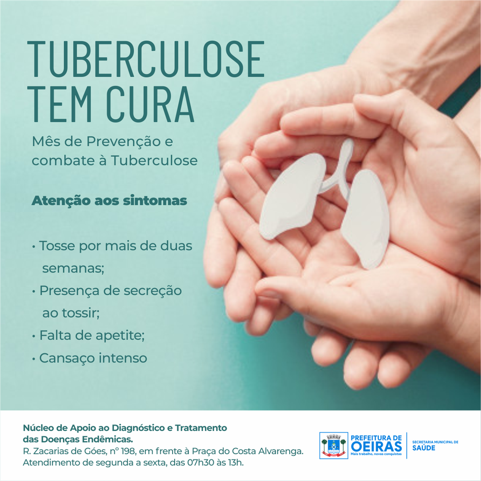 Secretaria Municipal de Saúde intensifica ações de combate à tuberculose em Oeiras