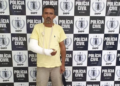 Jairo Silva Santana