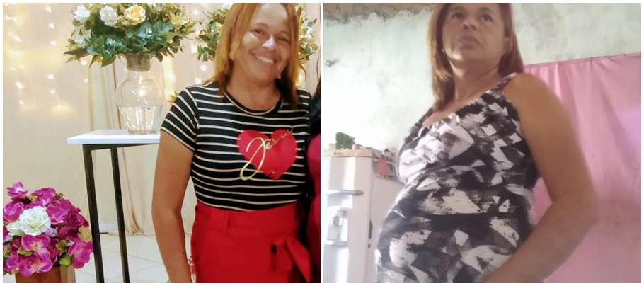 Os inchaços acontecem em grande proporção