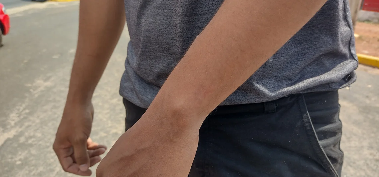 Motociclista ficou ferido