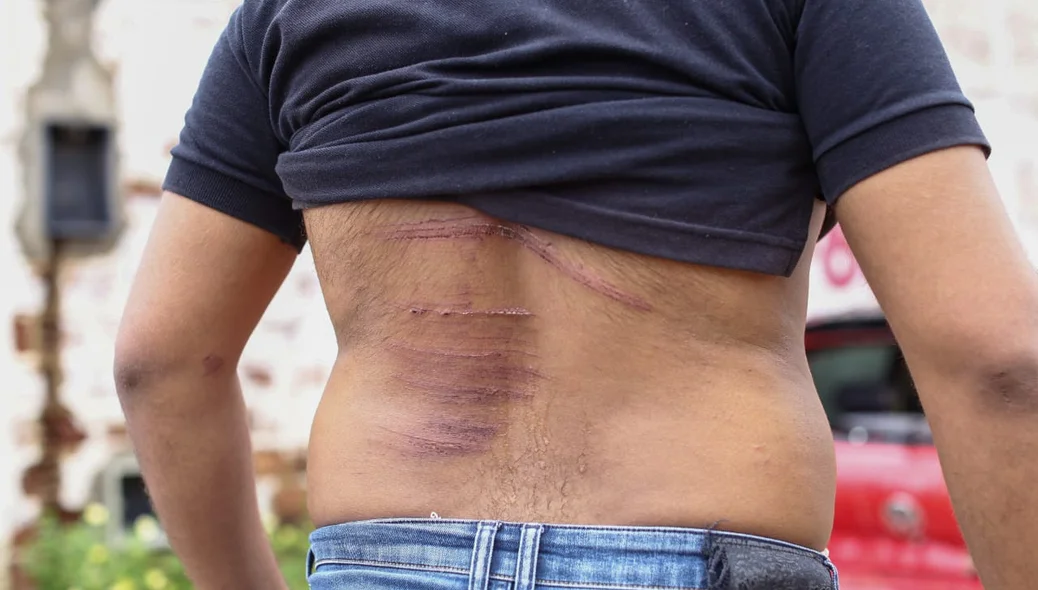 A vítima ficou com várias escoriações pelo corpo