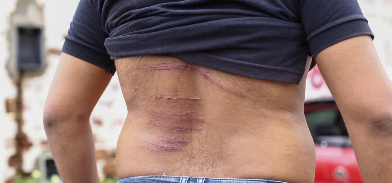 A vítima ficou com várias escoriações pelo corpo
