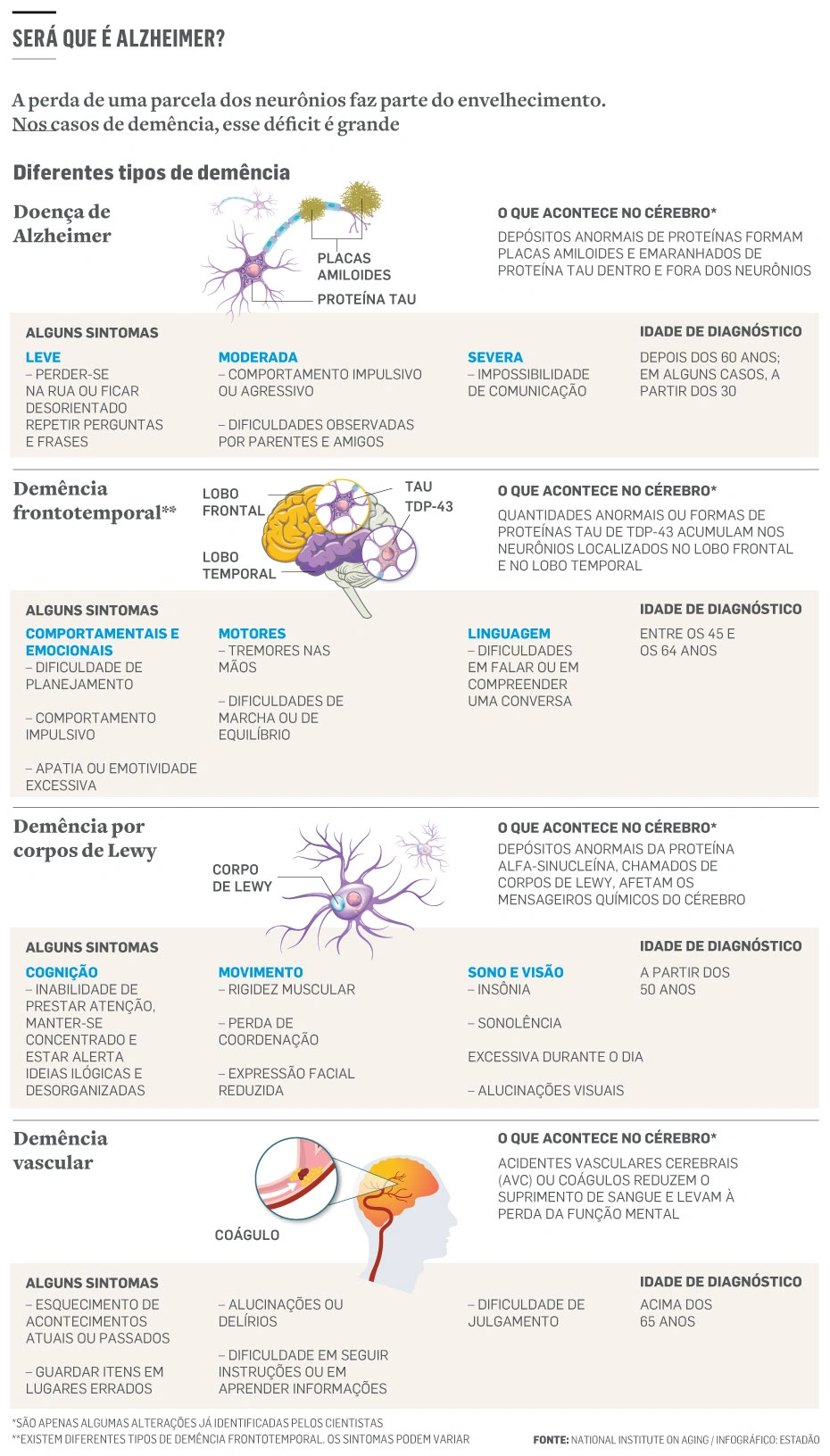 Alzheimer: sinais podem ser detectados precocemente