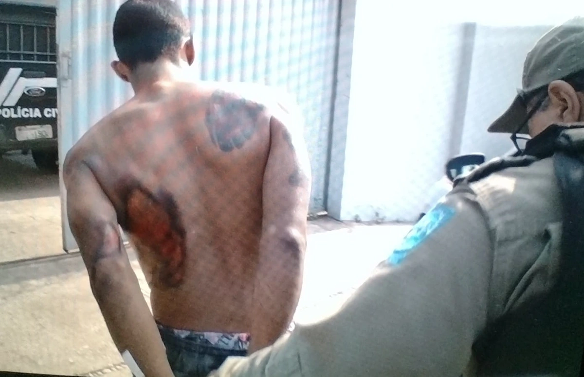 Bandido que foi atropelado após assalto
