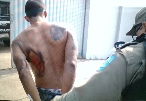 Bandido que foi atropelado após assalto