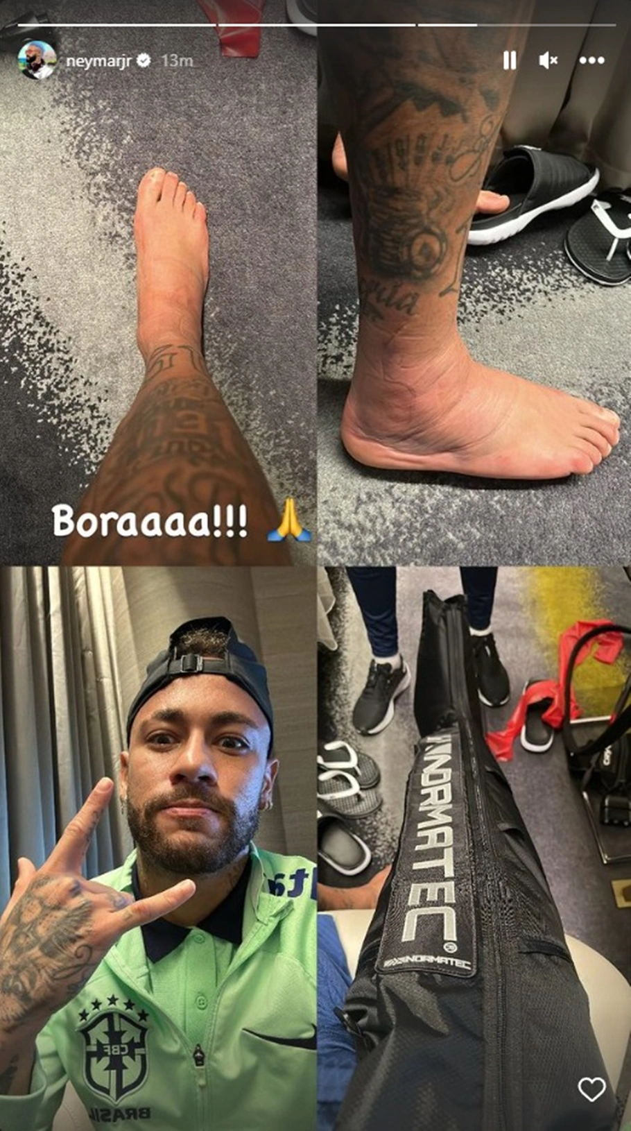 Neymar está sob tratamento da fisioterapia da seleção brasileira