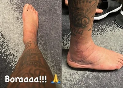 Tornozelo direito de Neymar, lesionado no confronto entre Brasil e Sérvia, na estreia da Copa do Mundo do Catar