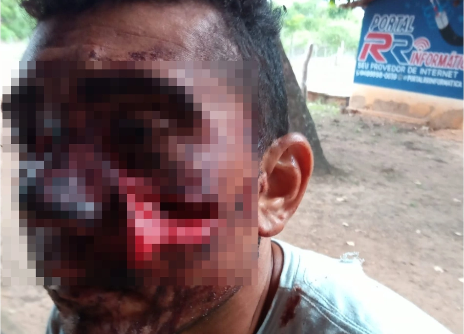 Vítima ficou ferida no rosto