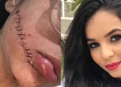 Jovem depois e antes do ocorrido