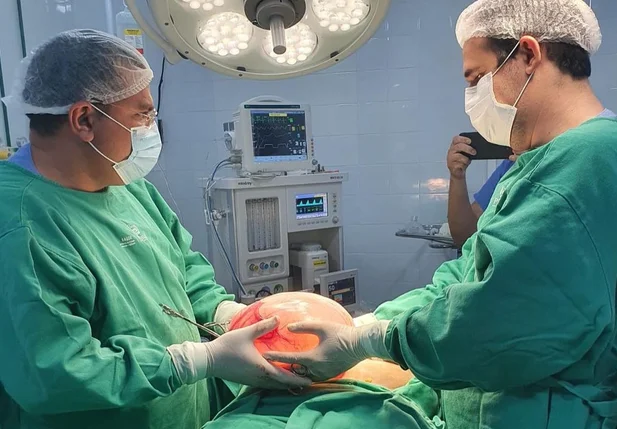 Momento em que os médicos retiram o cisto