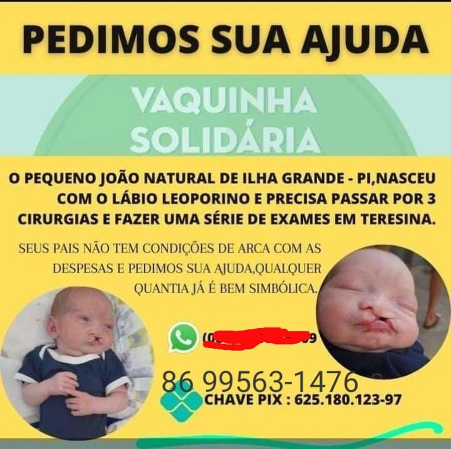 Vaquinha solidária para o bebê João