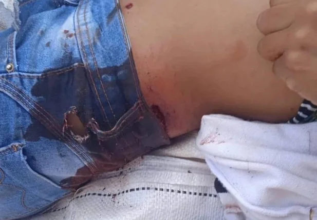 Indígena ferida durante confronto com policiais militares em Mato Grosso do Sul