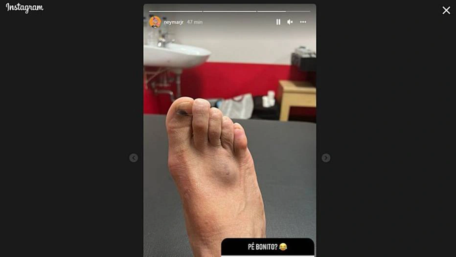 Neymar postou foto do pé no stories do Instagram