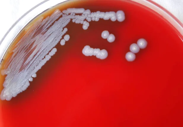 Burkholderia pseudomallei