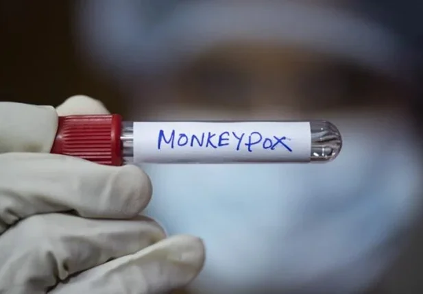 Teste positivo para varíola dos macacos