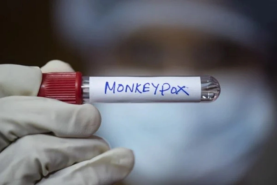 Teste positivo para varíola dos macacos