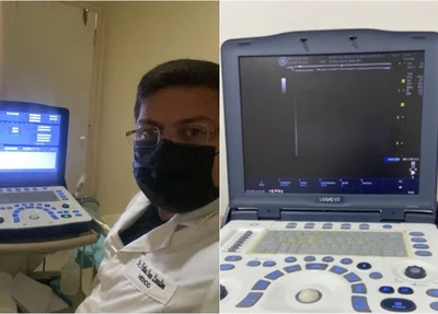 Equipamento foi furtado de dentro do veículo do médico Arthur Paes Landim