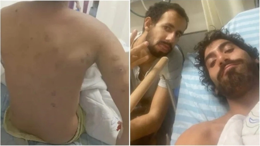Brasileiro atingido por estilhaços está internado.