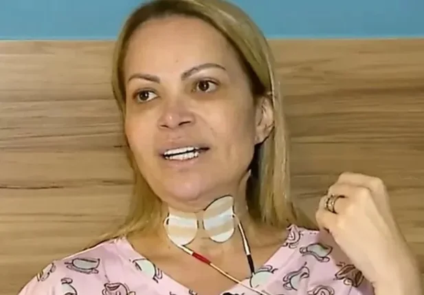 Cantora Solange Almeida revela lesões nas cordas vocais e nos pulmões, consequência do uso de cigarros eletrônicos