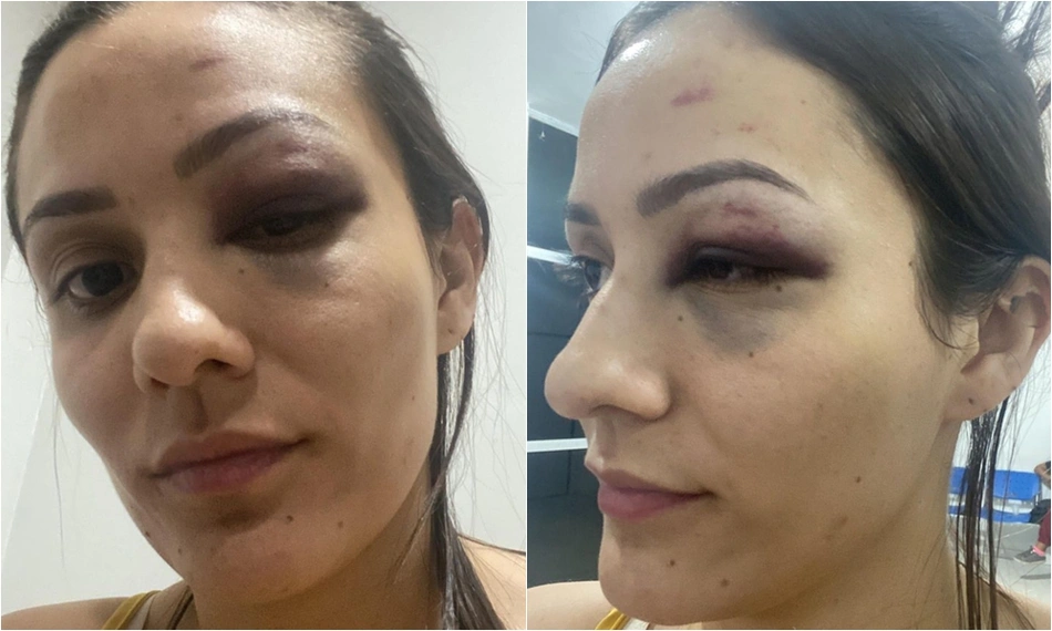 Carlene Nobre