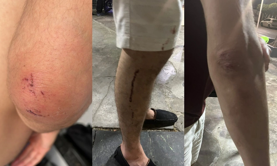 Casal é agredido por estudante de medicina em bar na cidade de Parnaíba