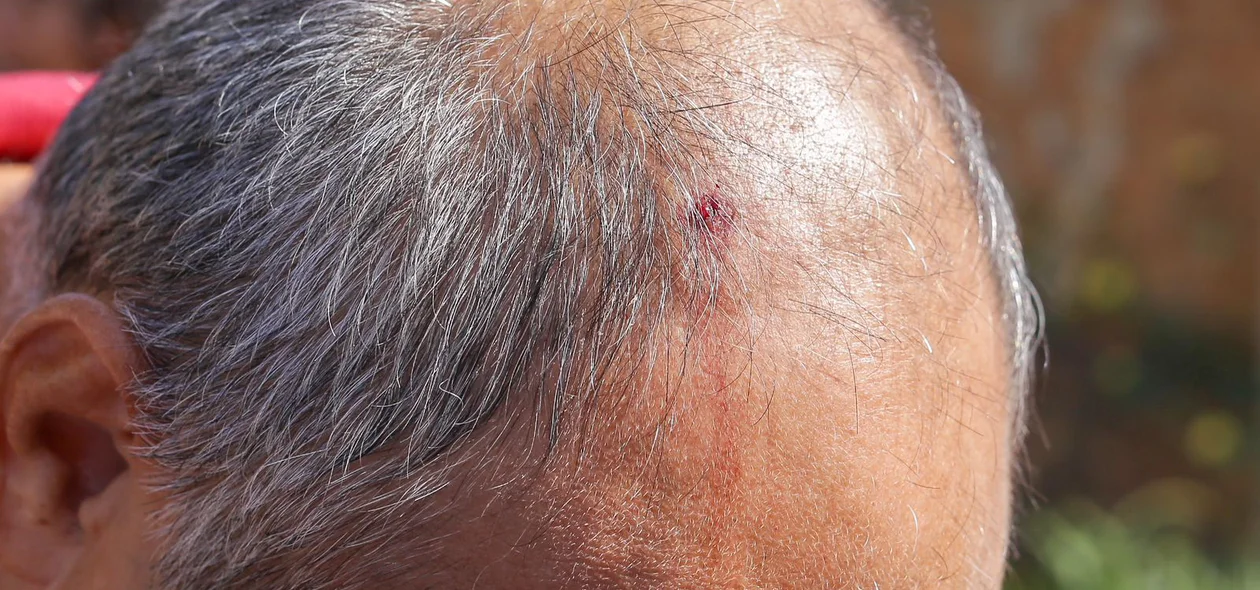 Cinegrafista ficou ferido com a coronhada na cabeça