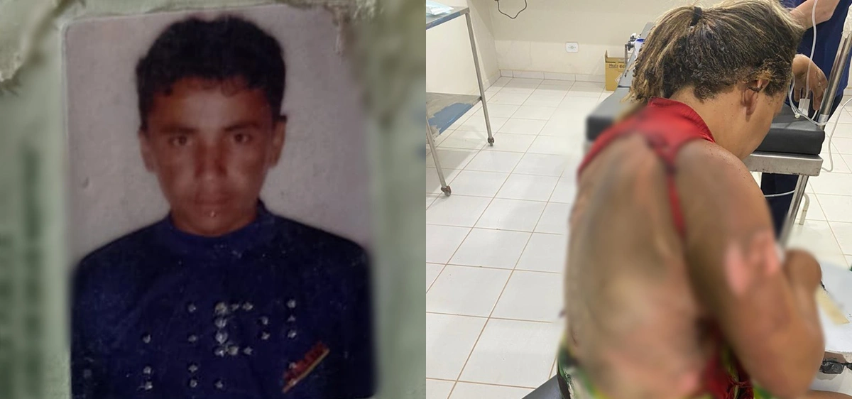 Homem é preso por atear fogo na esposa enquanto ela dormia