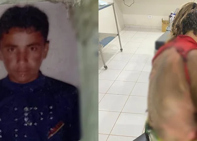 Homem é preso por atear fogo na esposa enquanto ela dormia