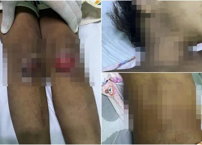 Maria Eduarda apresentava sinais de violência por todo o corpo