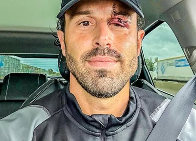 Fabio Grosso levou 12 pontos após o ataque
