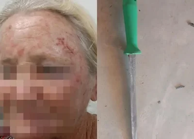 Idosa perfurou a barriga do assaltante durante reação a um roubo