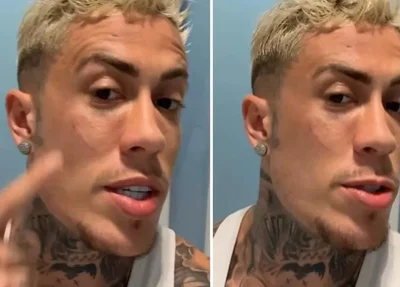 MC Daniel mostra rosto após confusão