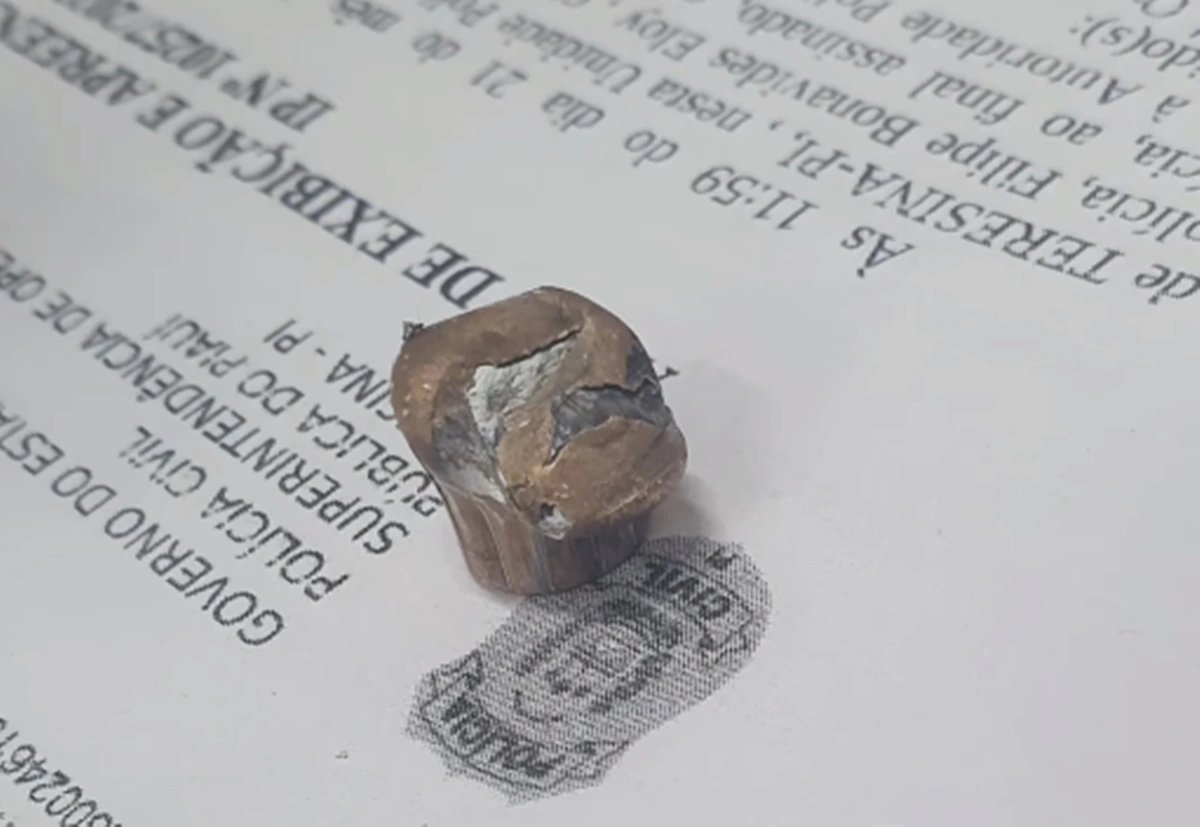 Projétil que atingiu a perna do pastor Calebe Veras