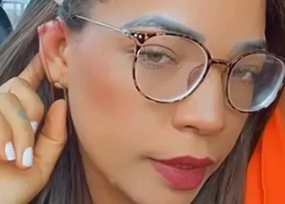 A vendedora Raylland Ferreira Barros publicou uma foto mostrando o ferimento na orelha
