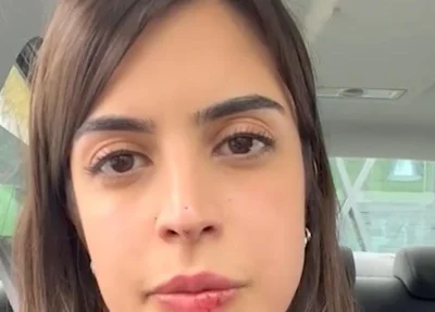 Deputada federal Tabata Amaral mostra os ferimentos que sofreu nos lábios