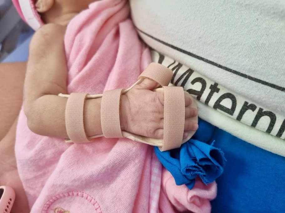 Nova Maternidade Dona Evangelina Rosa produz órteses para  bebês prematuros