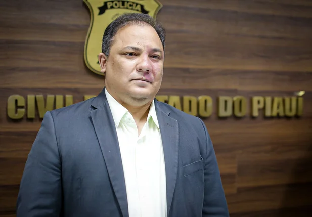 Delegado-geral da Polícia Civil do Piauí, Luccy Keiko