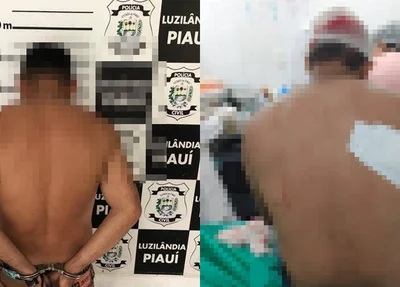 Acusado de tentativa de homicídio preso e a vítima recebendo atendimento médico em Luzilândia