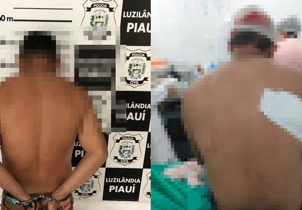 Acusado de tentativa de homicídio preso e a vítima recebendo atendimento médico em Luzilândia