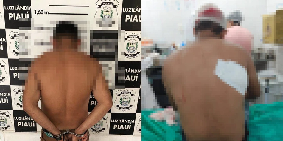 Acusado de tentativa de homicídio preso e a vítima recebendo atendimento médico em Luzilândia